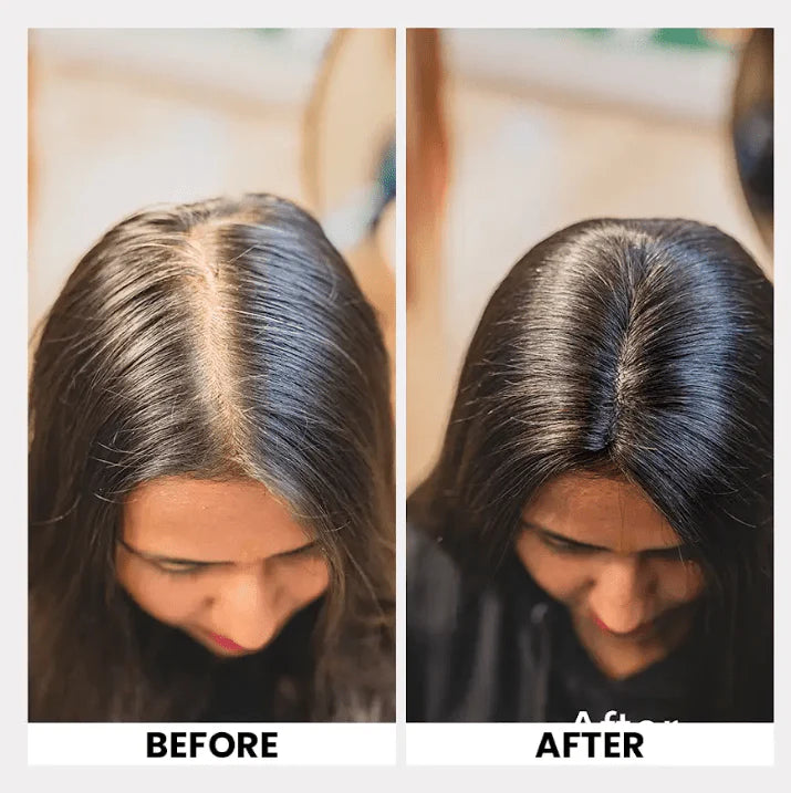 Lace Topper Hair Extensions