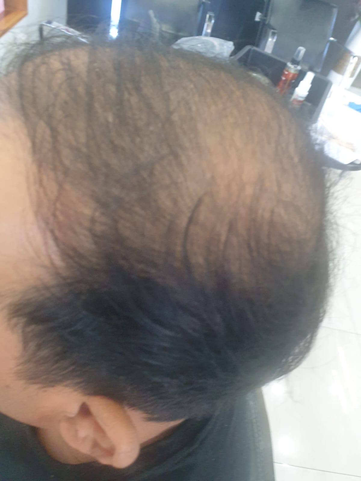 Los Angeles Men Patch