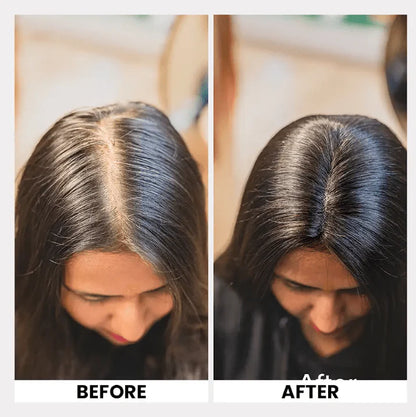 Lace Topper Hair Extensions